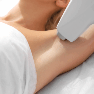 Laser Treatments