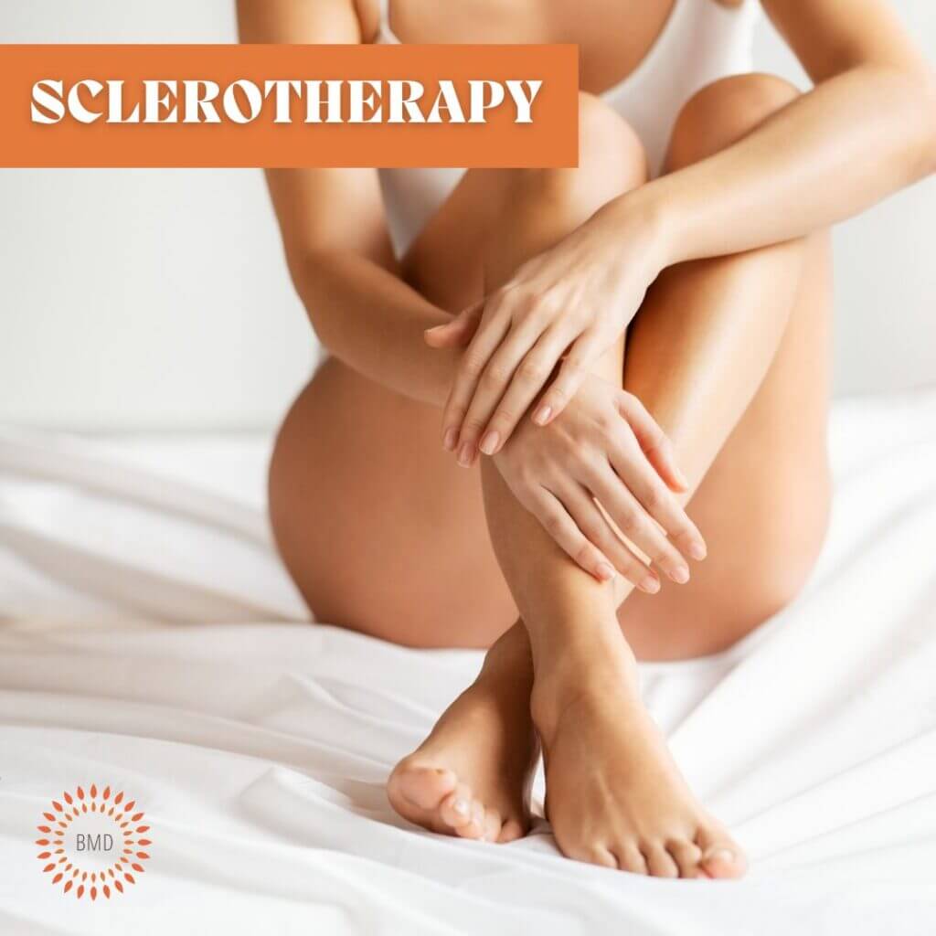 Remove spider veins at Bryn Mawr Dermatology with sclerotherapy